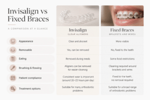 Invisalign vs fixed braces